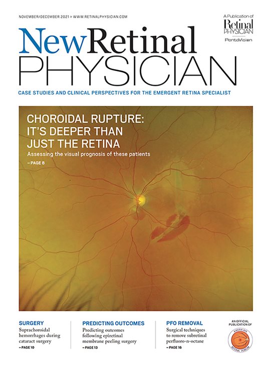 New Retinal Physician